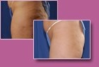 Body-Jet Case Study