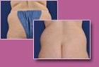 Body-Jet Case Study