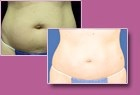 Body-Jet Case Study