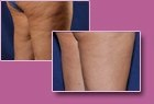 Body-Jet Case Study