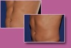 Body-Jet Case Study